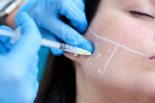 Botox in Dentistry